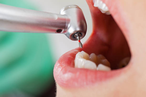 Best Broken or Chipped Tooth Repair in Harlan, KY